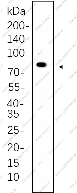 Recombinant Phospho-PKC α (Thr638) Monoclonal Antibody - 1