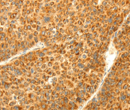 DIABLO Polyclonal Antibody - 3
