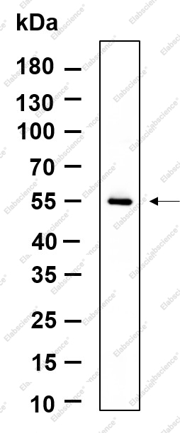 Recombinant TXNIP Monoclonal Antibody - 1