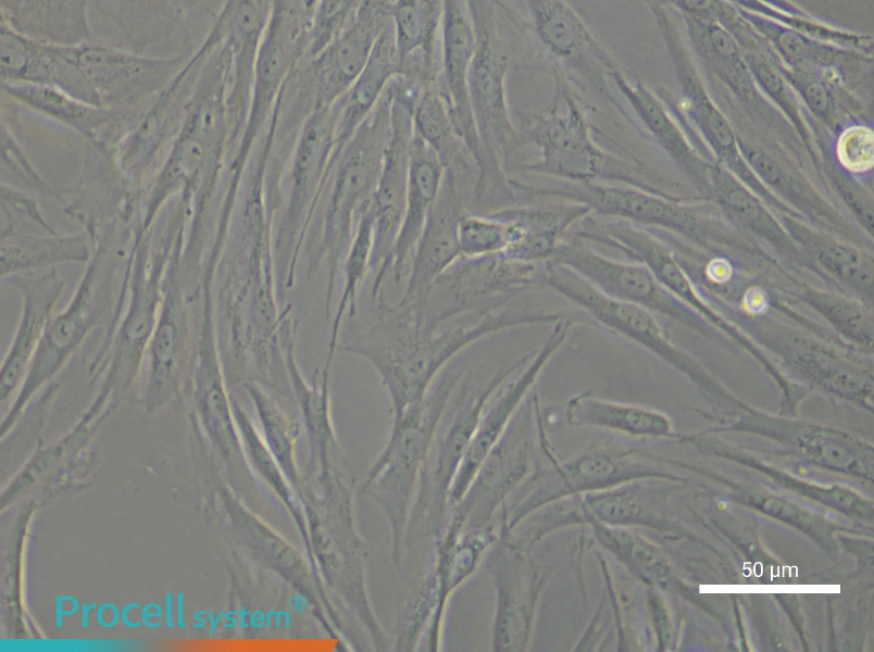 Human Oral Mucosal Fibroblast Complete Medium - small - 6