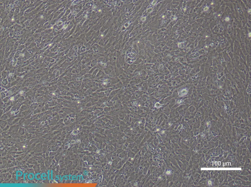 Rat Scleral Fibroblast Complete Medium - 2