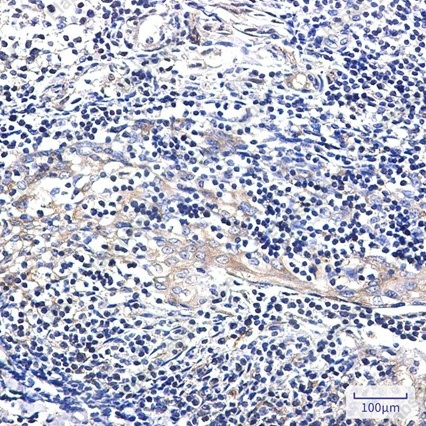 Recombinant EBP1 Monoclonal Antibody - 3