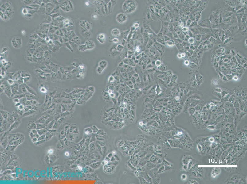 OVCAR-8 Cell Complete Medium - 1