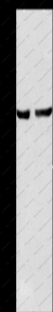 SERPINB5 Polyclonal Antibody - 1