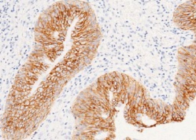 Recombinant EpCAM/TROP-1/TACSTD1 Monoclonal Antibody - small - 4