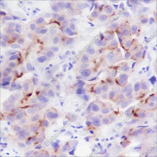 Recombinant Phospho-Girdin (Tyr1765) Monoclonal Antibody - 1