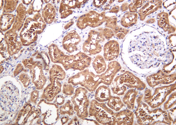 Recombinant PGK1 Monoclonal Antibody-searchlist-1