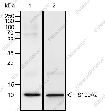Recombinant S100A2 Monoclonal Antibody - 1