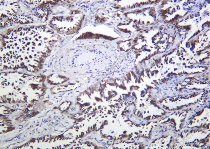 Recombinant TTF1 Monoclonal Antibody - 2