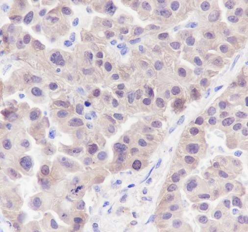 Recombinant GST3/GSTP1 Monoclonal Antibody - 2