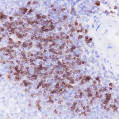 Recombinant TCL1 Monoclonal Antibody - small - 2