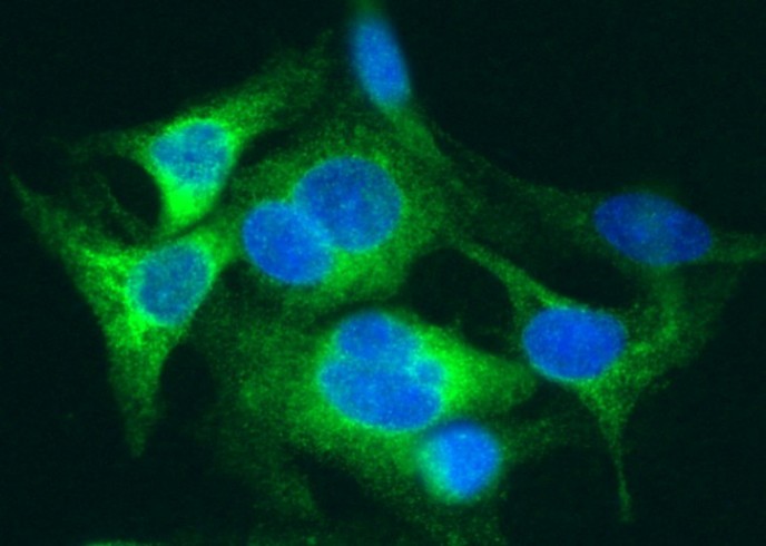 Recombinant SAA4 Monoclonal Antibody - small - 2