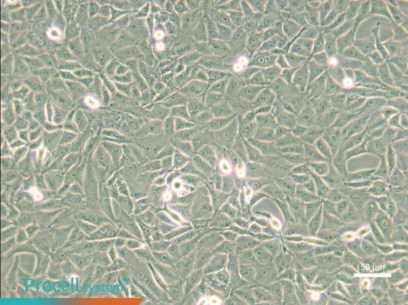 9L/lacZ Cell Complete Medium - small - 4