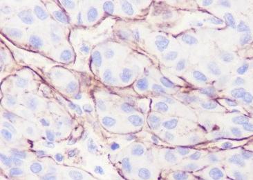 Recombinant Glypican-3 Monoclonal Antibody-searchlist-2