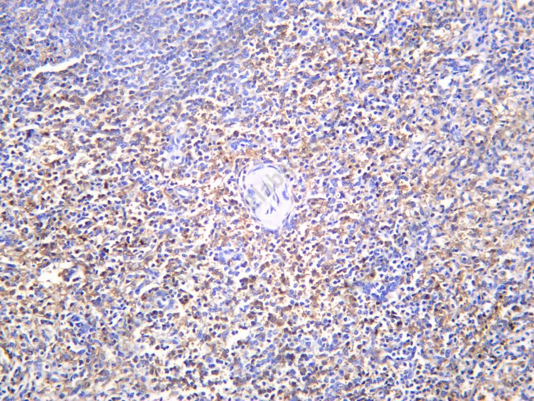 Recombinant Hemoglobin subunit alpha Monoclonal Antibody - 1