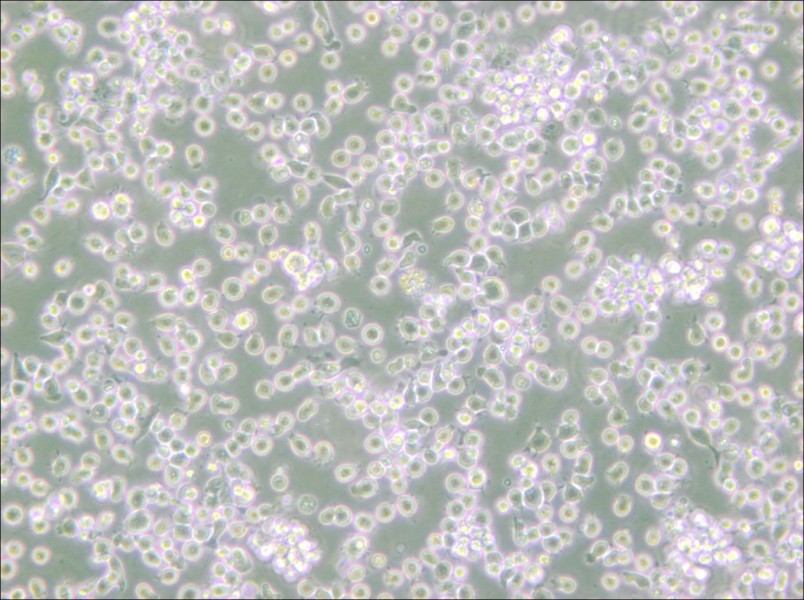 ARH-77 Cell Complete Medium - small - 5