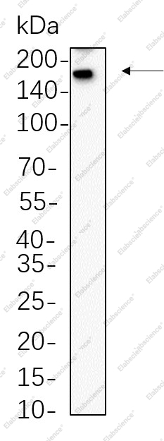 Recombinant Sall4 Monoclonal Antibody - 1