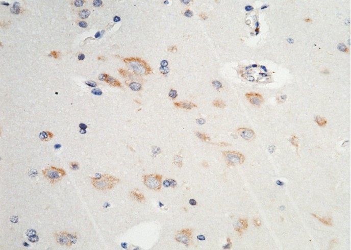 P4HB/ERBA2L Monoclonal Antibody - small - 3