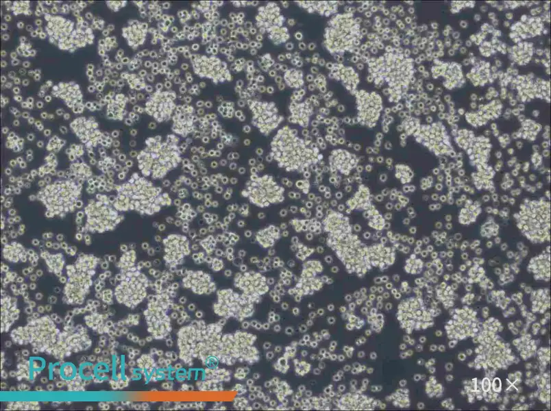 WSU-DLCL2 Cell Complete Medium - 3