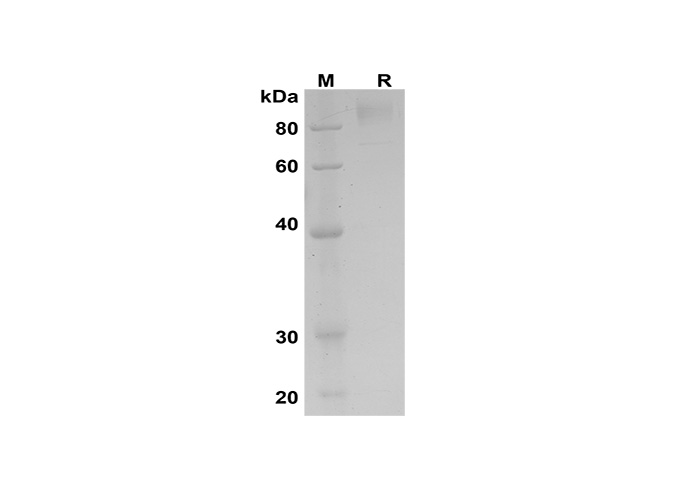 Recombinant Human CEACAM8/CD66b/CD67 Protein(His Tag)-产品推荐-1