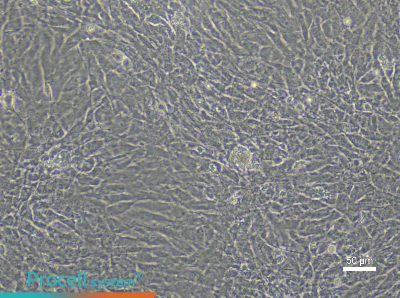 Rabbit Aortic Smooth Muscle Cell Complete Medium - 6