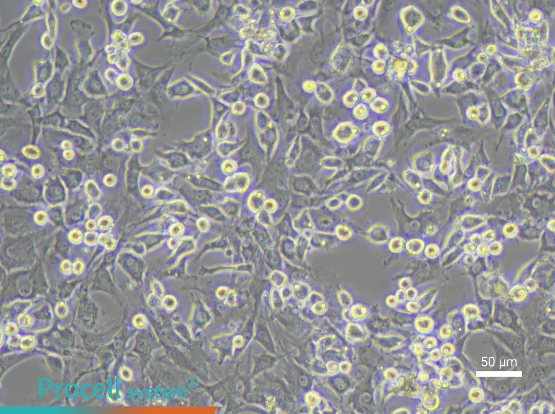 Mouse Intervertebral Disc Annulus Fibrosus Cell Complete Medium - 5