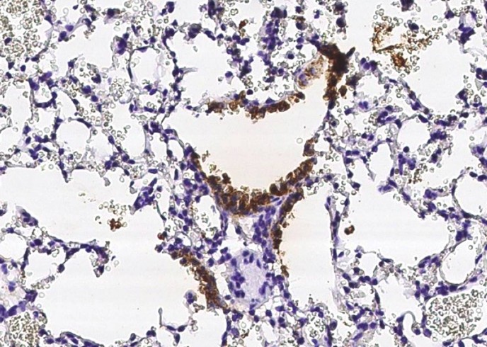 Recombinant Uteroglobin/SCGB1A1 Monoclonal Antibody-searchlist-1
