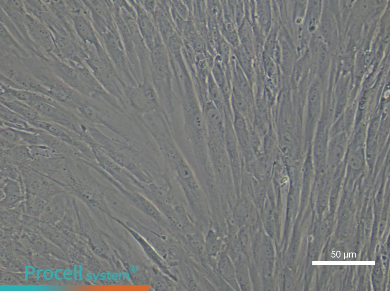 Human Keloid Fibroblast Complete Medium - small - 4