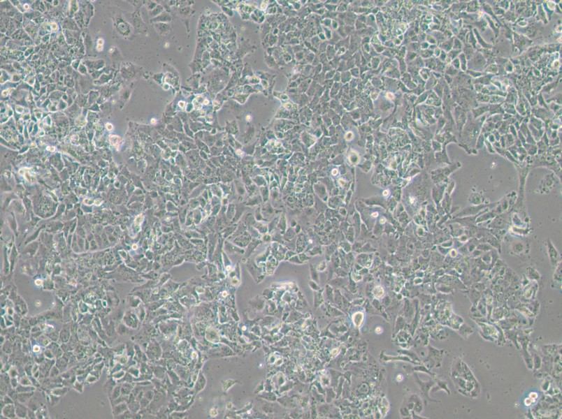 OV-90 Cell Complete MediumOV-90 Cell Complete Medium - 2