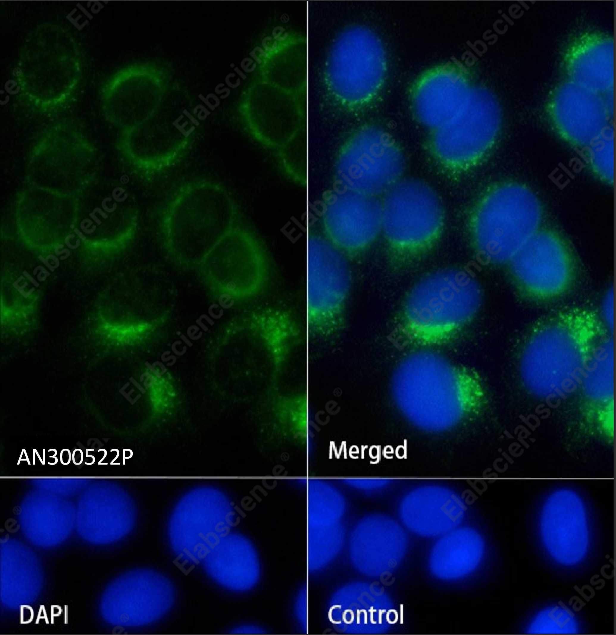 Recombinant IFNAR1 Monoclonal Antibody - 3