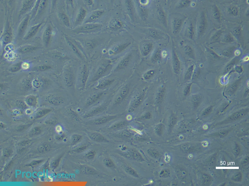 Human Endometrial Epithelial (Primary cell immortalization) Cell Complete MediumHuman Endometrial Epithelial (Primary cell immortalization) Cell Complete Medium - 5