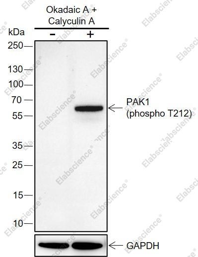 Recombinant Phospho-PAK1 (Thr212) Monoclonal Antibody - 2