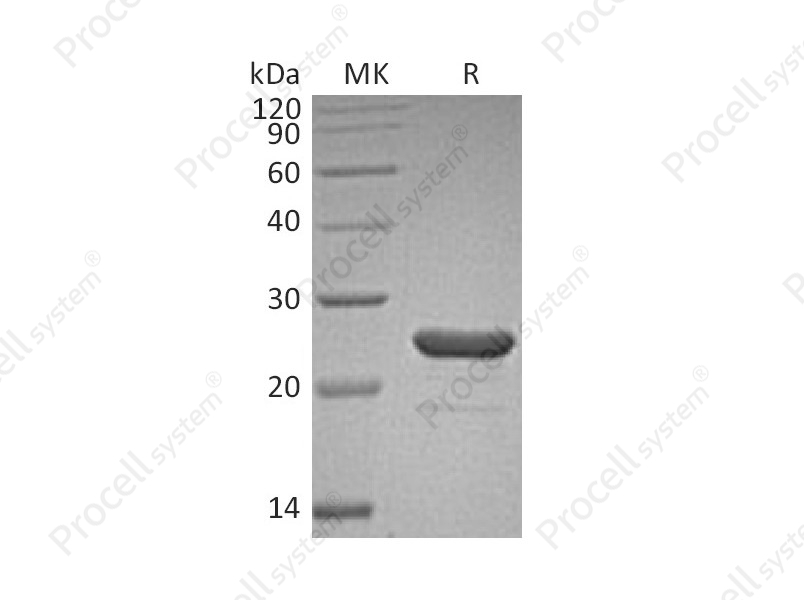 FGF-9/HBGF-9/GAF, Human, Recombinant