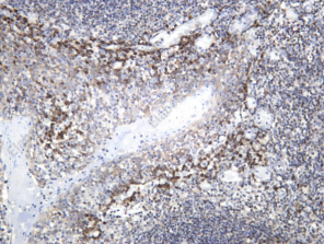 Recombinant Msi2 Monoclonal Antibody - 1