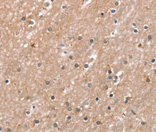 RAB8A Polyclonal Antibody - 2