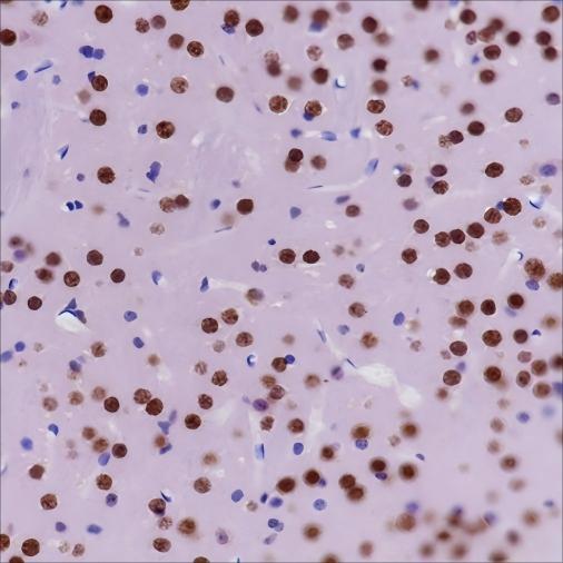 Recombinant PTBP2 Monoclonal Antibody - 3