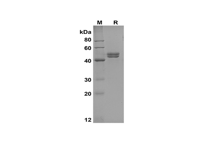 Recombinant Human ICAM-1/CD54 Protein (His Tag)-产品推荐-1