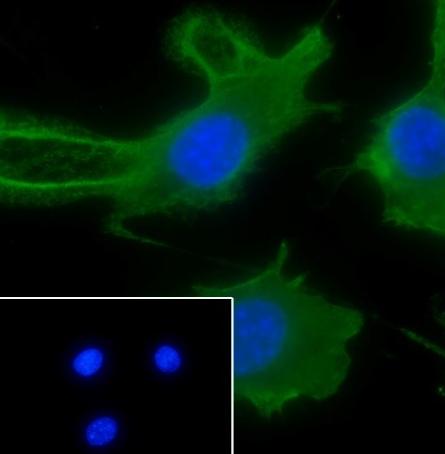 Recombinant ATG4B Monoclonal Antibody - 3