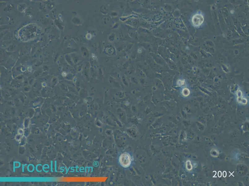 HuCC-T1 Cell Complete Medium - 5
