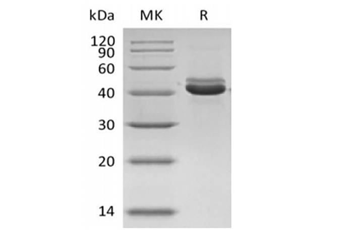 Recombinant Human G-CSF Protein(Trx Tag)-产品推荐-1