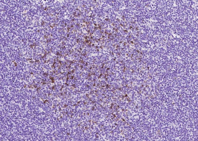 CD10 Monoclonal Antibody - small - 3