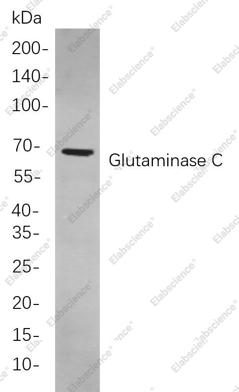 Recombinant Glutaminase C Monoclonal Antibody - 1