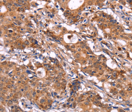 SIGLEC5 Polyclonal Antibody - 2