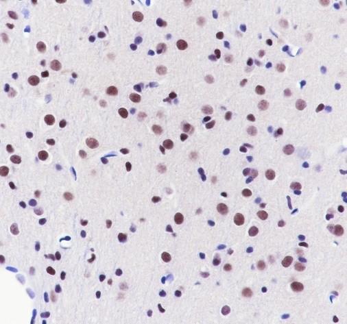 Recombinant CHD4 Monoclonal Antibody - small - 5