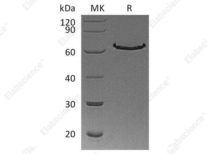 Recombinant Human DLL1/Delta-1 Protein (His Tag) - 1