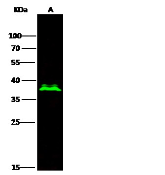 Recombinant Olig-2/Oligo2 Monoclonal Antibody - small - 3