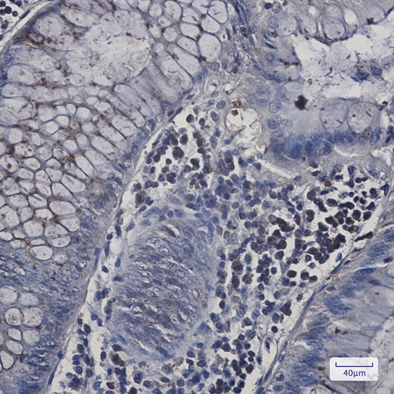 Recombinant N WASP Monoclonal Antibody - 3