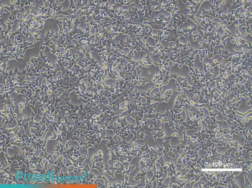 22RV1 Cell Complete Medium - 1