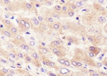 Recombinant Hemopexin Monoclonal Antibody-searchlist-2