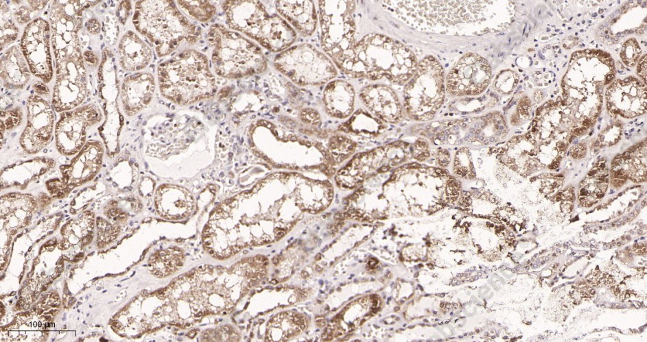 Recombinant SDHA Monoclonal Antibody - 2